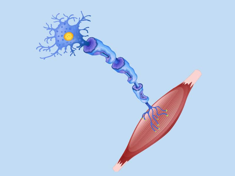 Amyotrophic Lateral Sclerosis (ALS)